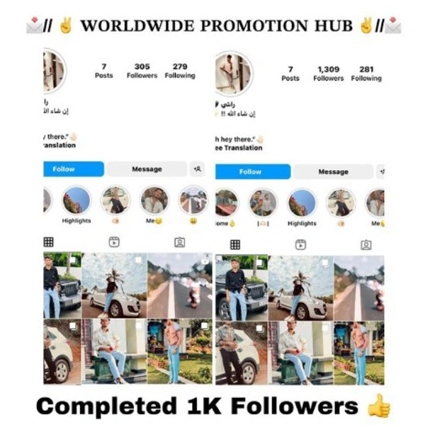 Instagram Instant  Followers 