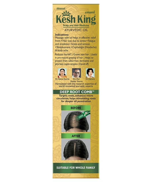 KESH KING Ayurvedic Oil - 300 ml.