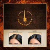 HUL Indulekha  Bringha Oil 50Ml.