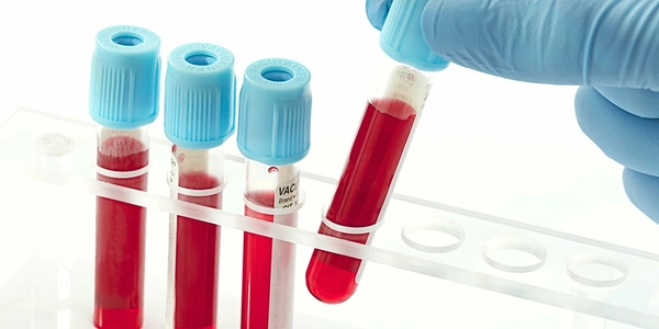 Blood Test