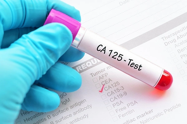 CA
125