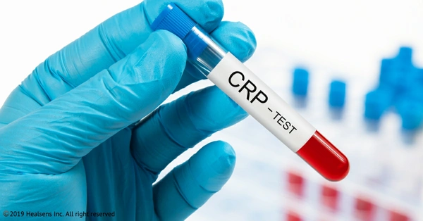 CRP
(
C
-
Reactive
Protein