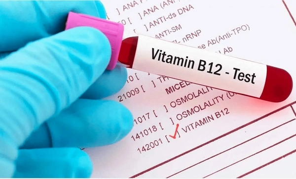 Vitamin B 12 Level