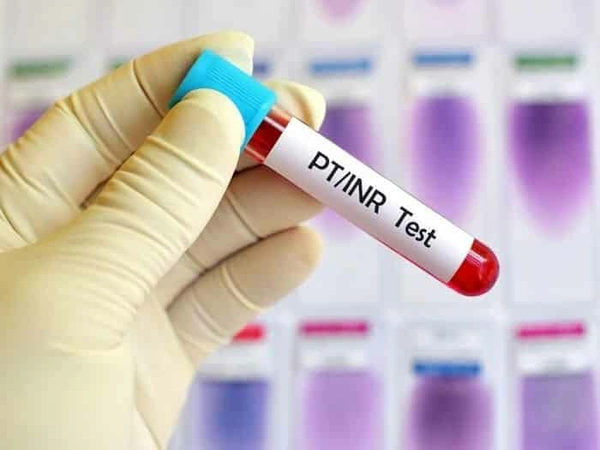 Prothrombin Time (PT)