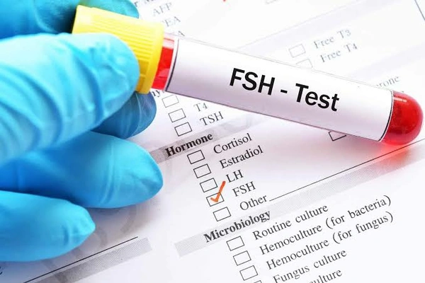 FSH & LH