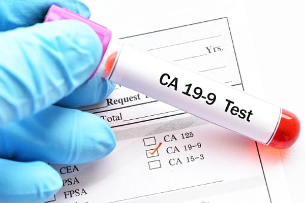 CA 19.9