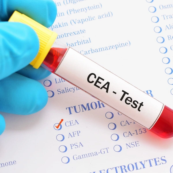 CEA