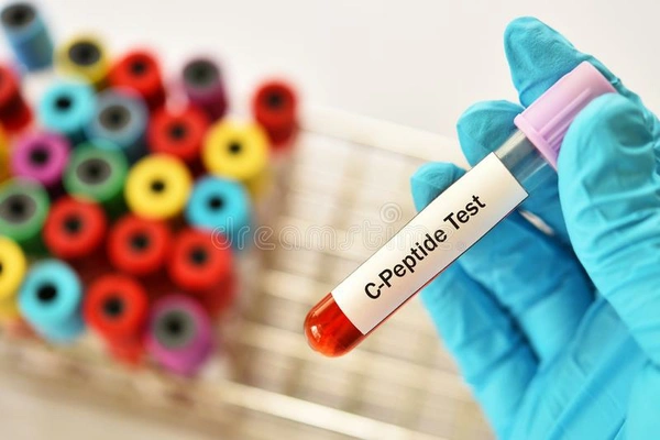 C Peptide F/PP