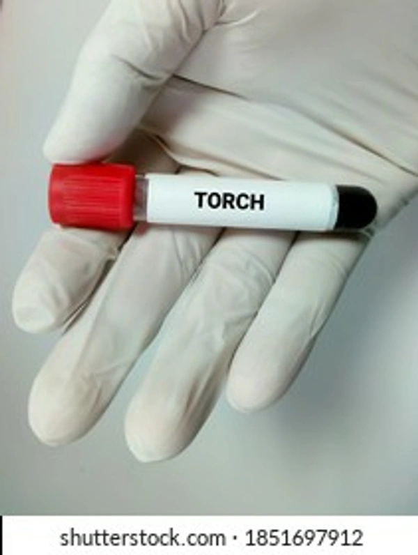 TORCH 4 Parameters