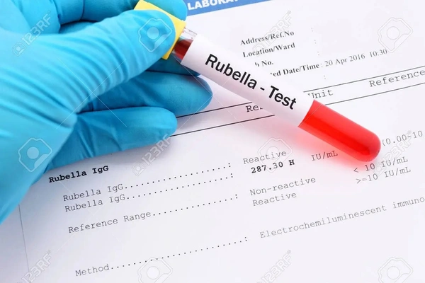 Rubella lgG & lgM