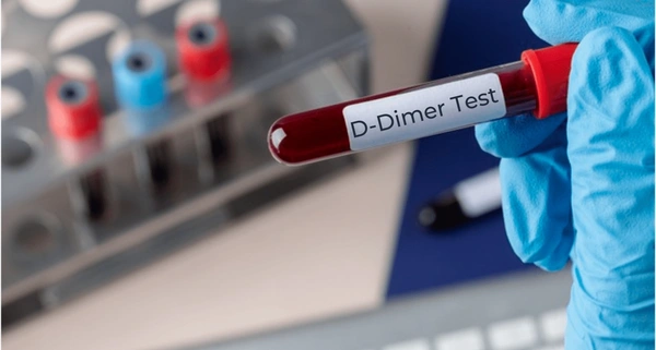 D_Dimer