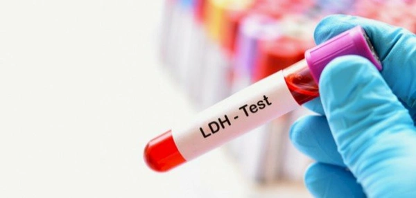 LDH