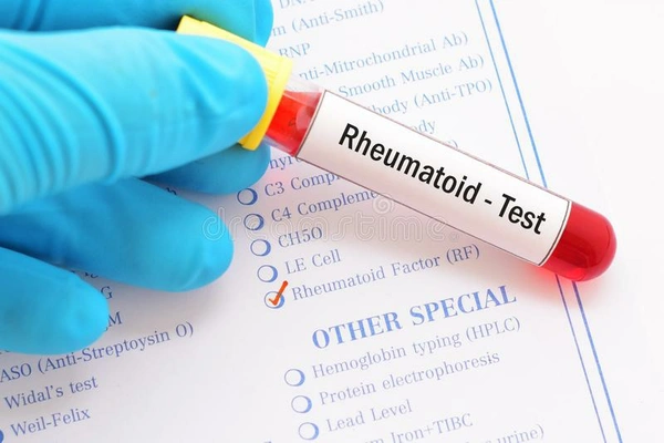 RA
Test