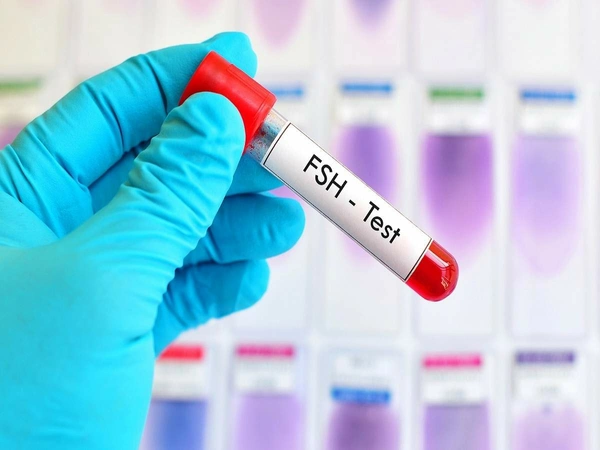 FSH-LH- Prolactin- Testosterone