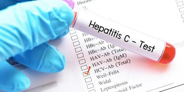 HCV Antibodies