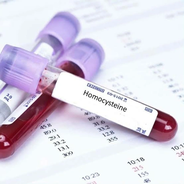 Homocysteine Levels