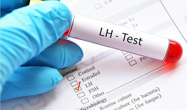 LH (Luteinizing Hormone)