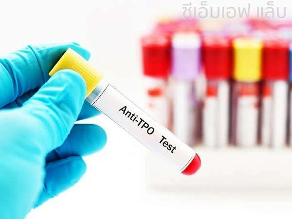 Microsomal Antibody (Anti TPO)