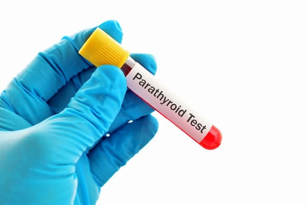 Parathyroid Hormone