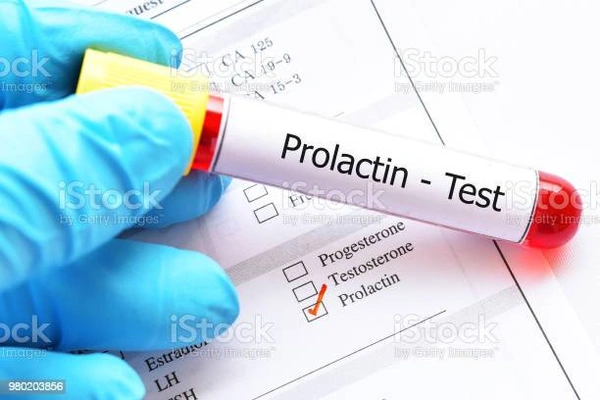 Prolactin