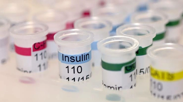 Serum Insulin