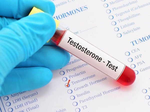 Total Testosterone
