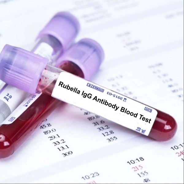 Rubella IgG Antibody