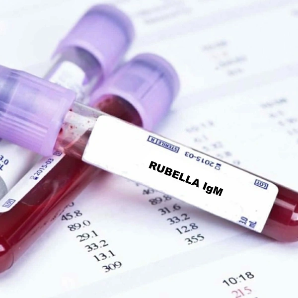Rubella IgM Antibody