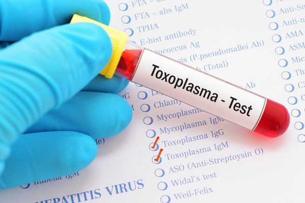 Toxoplasma IgG