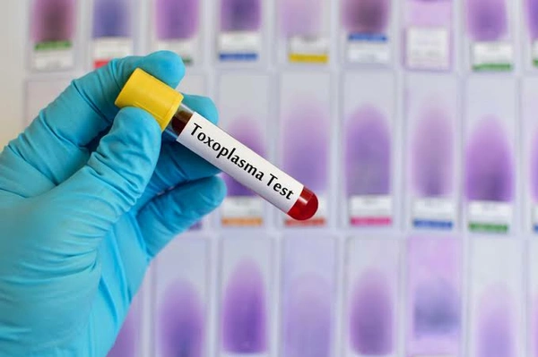 Toxoplasma IgM