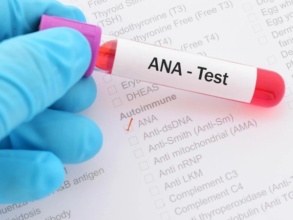 ANA Blot Test