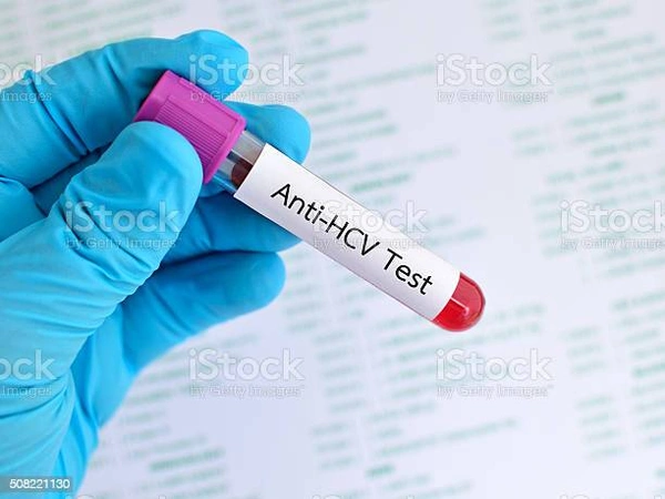 Anti HCV by Spot