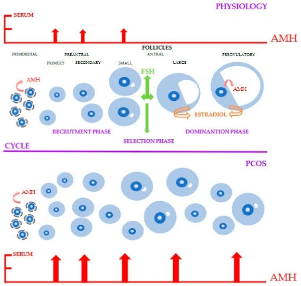 Anti Mullerial Inhibiting Substance (AMH)