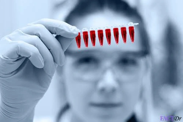 APA (Phospholipid antibody - IgG)
& APA (Phospholipid antibody - IgM)
