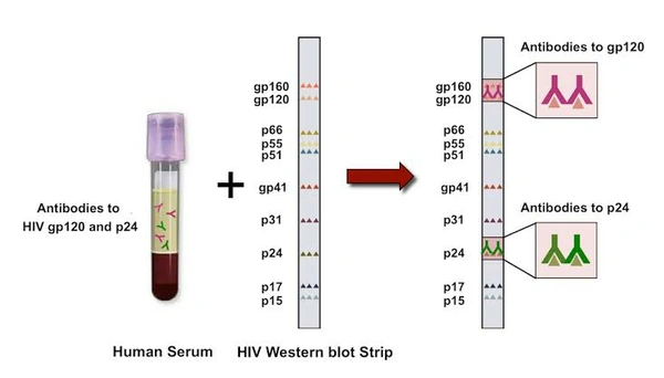 HIV I & II (Spot Test)
