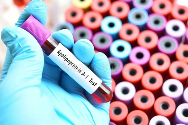 APO
Lipoproteins
A1
& B