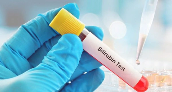 Bilirubin 