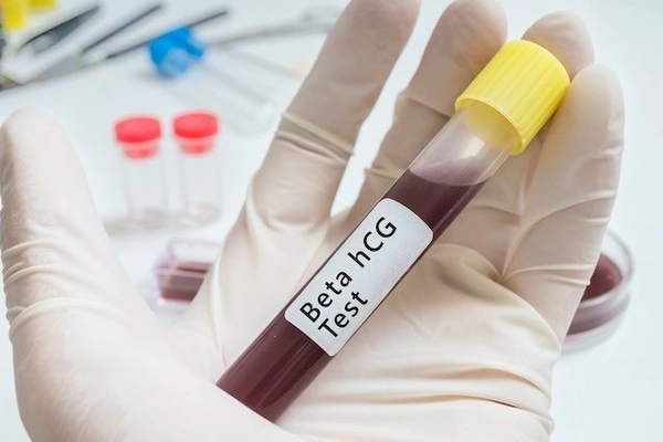 Free Beta HCG