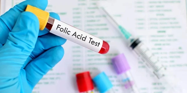 Folic Acid (Serum)