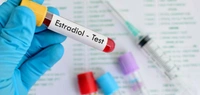 E2
(Oestradiol)