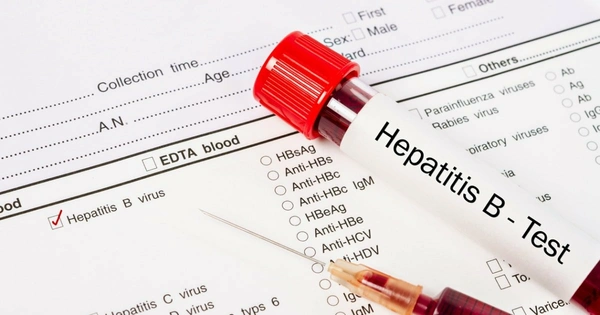 Australia
Antigen (HBsAg)