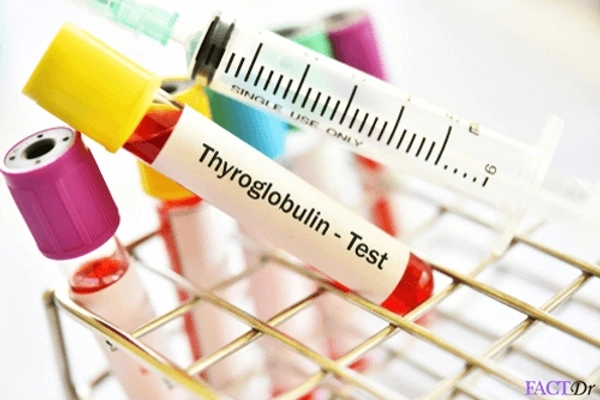 Anti Thyroglobulin
Antibody
(Tg)