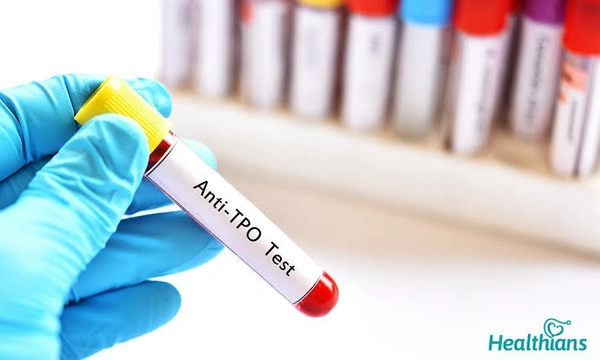 Anti Microsomal Antibody
(TPO)