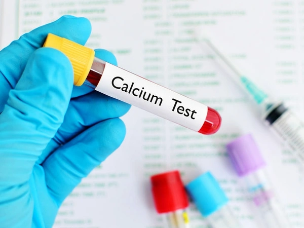 Calcium