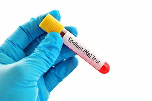 Sodium