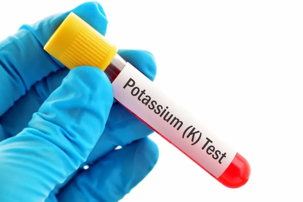 Potassium