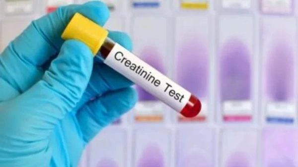 Creatinine