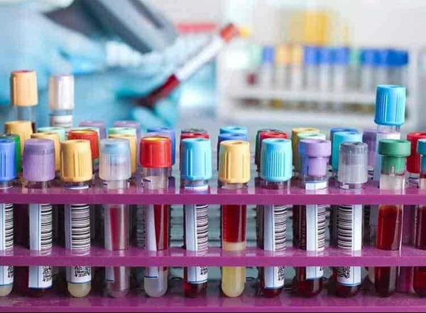 HB Electrophoresis ( Cellulose Acetate)