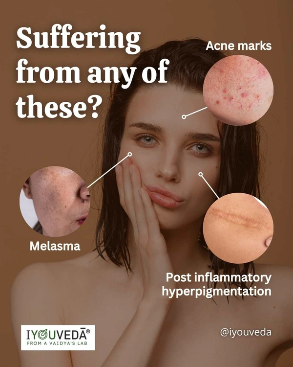 Tejak Anti-Pigmentation Serum - 15ml