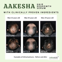 Aakesha Hair Regrowth Serum 3 Month Pack - 120ml